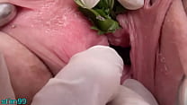 free mouth nettles in peehole urethral insertion nettles fisting cunt video